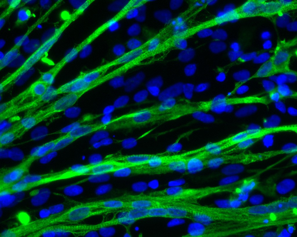 Researchers discover new way to make muscle cells from human stem cells