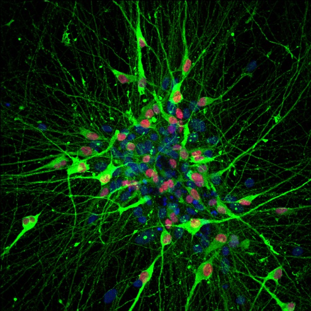 Photo: Serotonin neuron