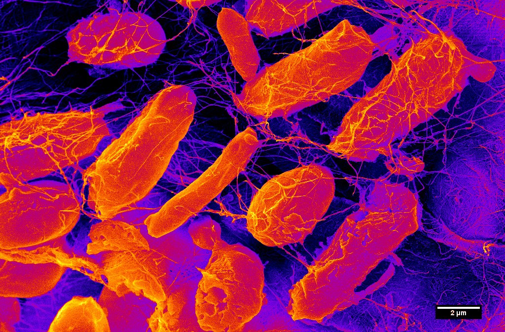 Photo: Microscopic image of microbiome bacteria