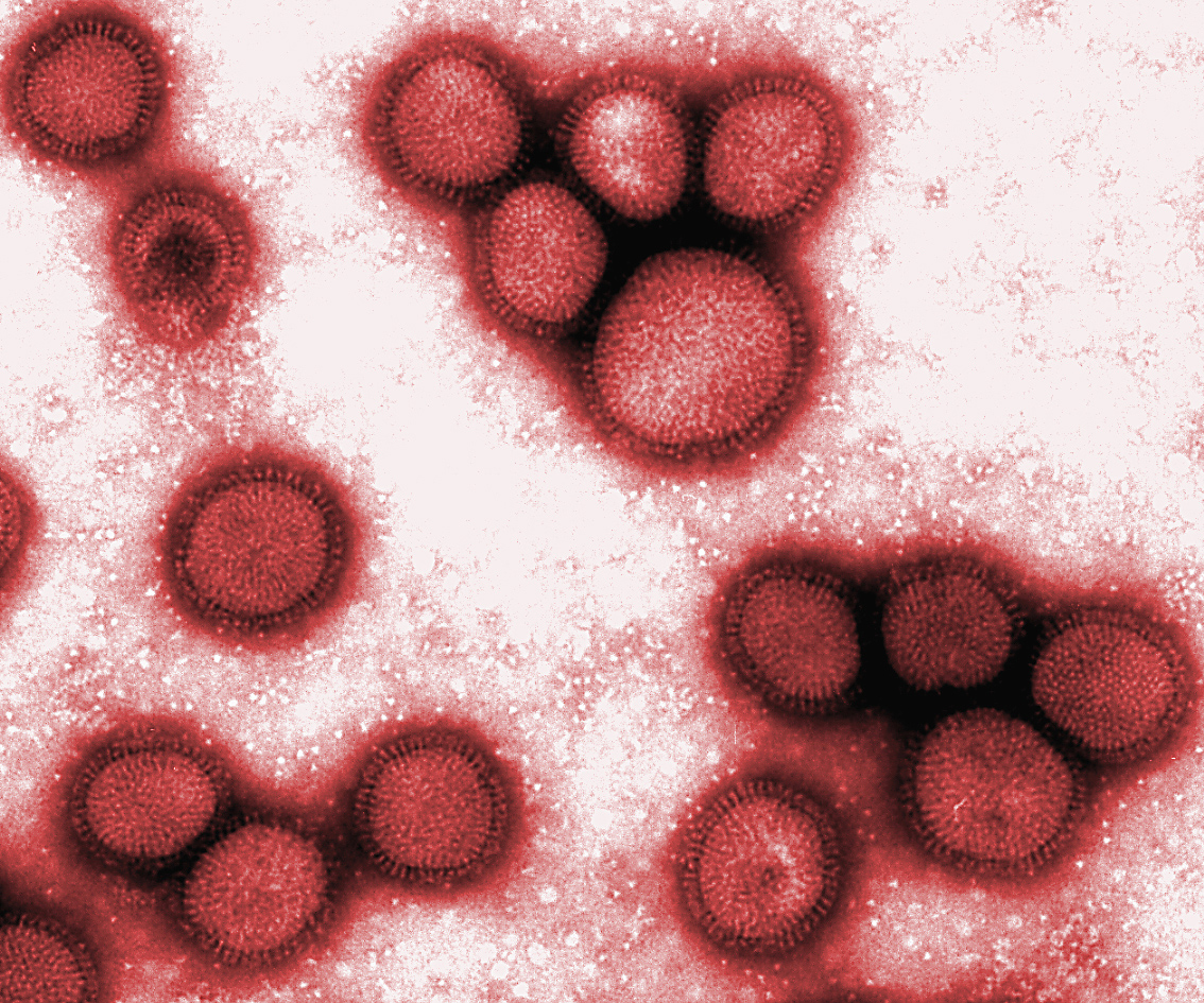 pictures of influenza