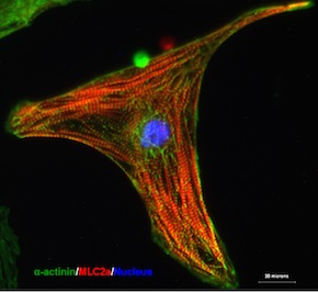 Heart Stem Cells