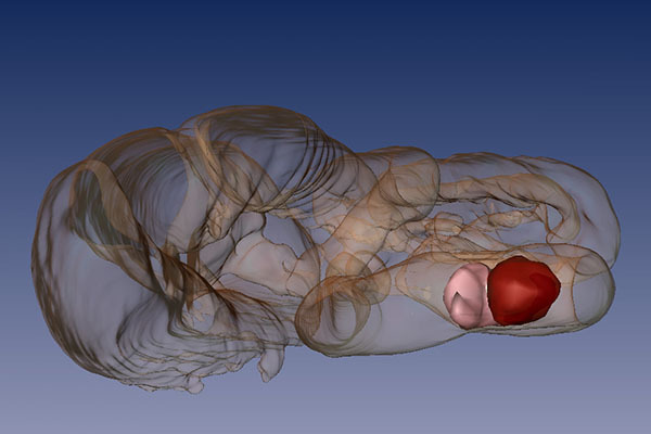 McArdle Laboratory research