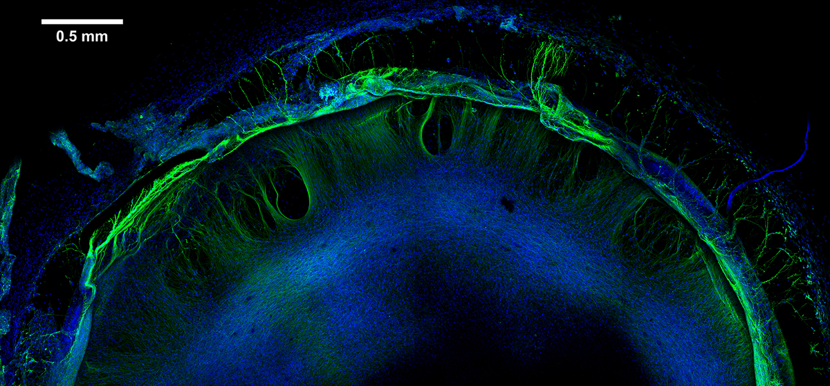 Photo: Microscopic image of nuclei and neurons