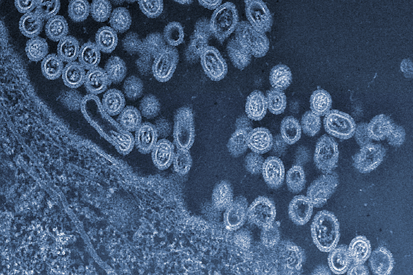 Photo: microscopic flu virus