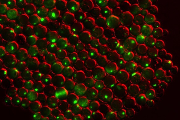 Photo: yeast cells