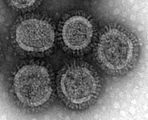Photo: microscopic image of H5N1 virus