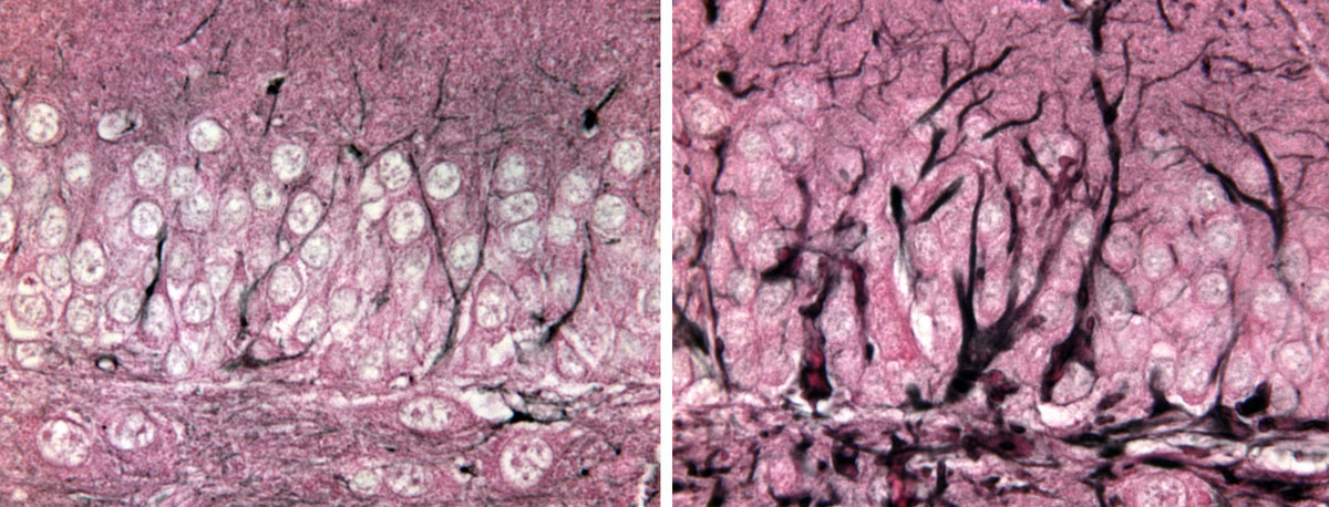 Photo: normal and diseased mouse brains