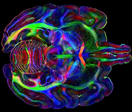 Monkey brain image