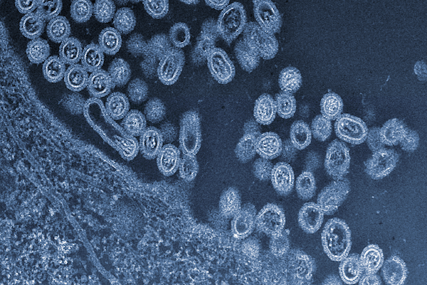 Photo: Infectious particles of the avian H7N9 virus emerge from a cell
