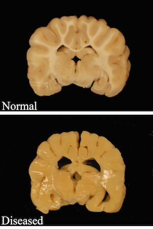 how do dogs get neurological disorders