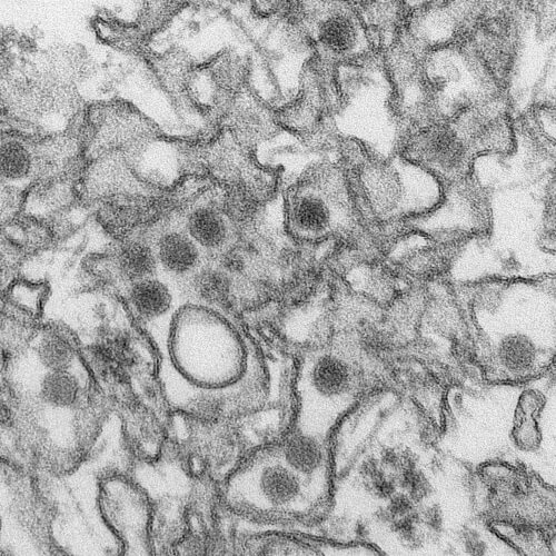 Transmission electron micrograph of the Zika virus. 