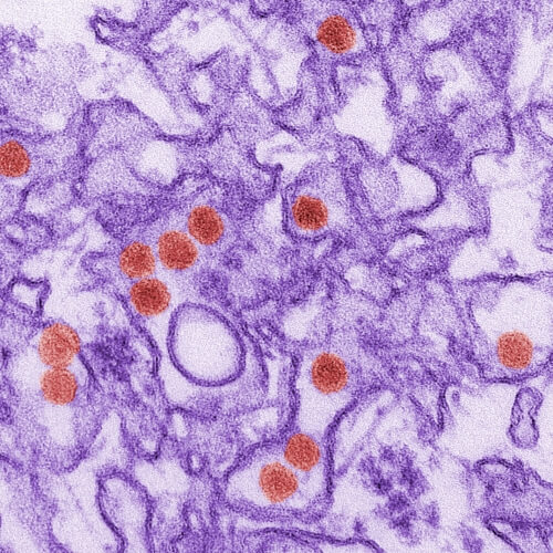 This is a digitally-colorized transmission electron micrograph (TEM) of Zika virus. Virus particles are colored red.
