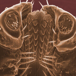 Electron microscope image of portion of a tick's body. Lots of spiky appendages in shades of brown