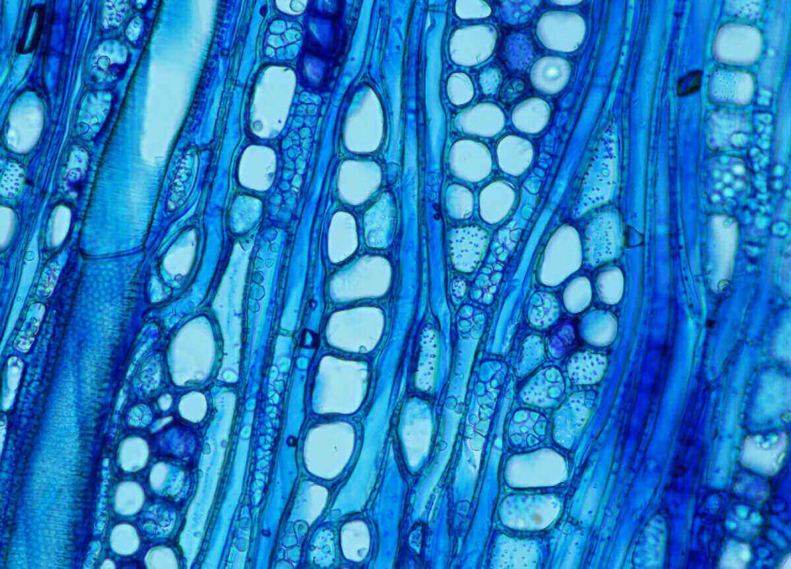 Механическая ткань растений сосуды. Флоэма микрофотография. Микрофотографии тканей растений. Флоэма растений под микроскопом. Ксилема микроскоп.