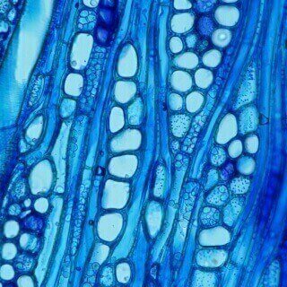 Photo of xylem magnified 200 times. Colors are outlined varying shades and hues of blue