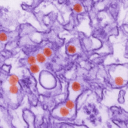 Photo: Micrograph of Zika virus