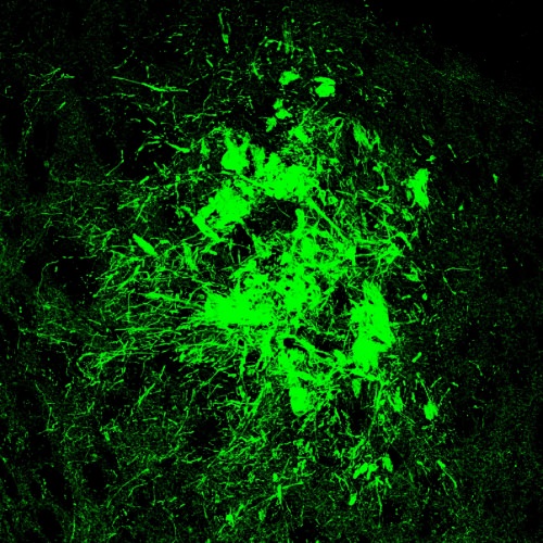 Photo: Nerve cells