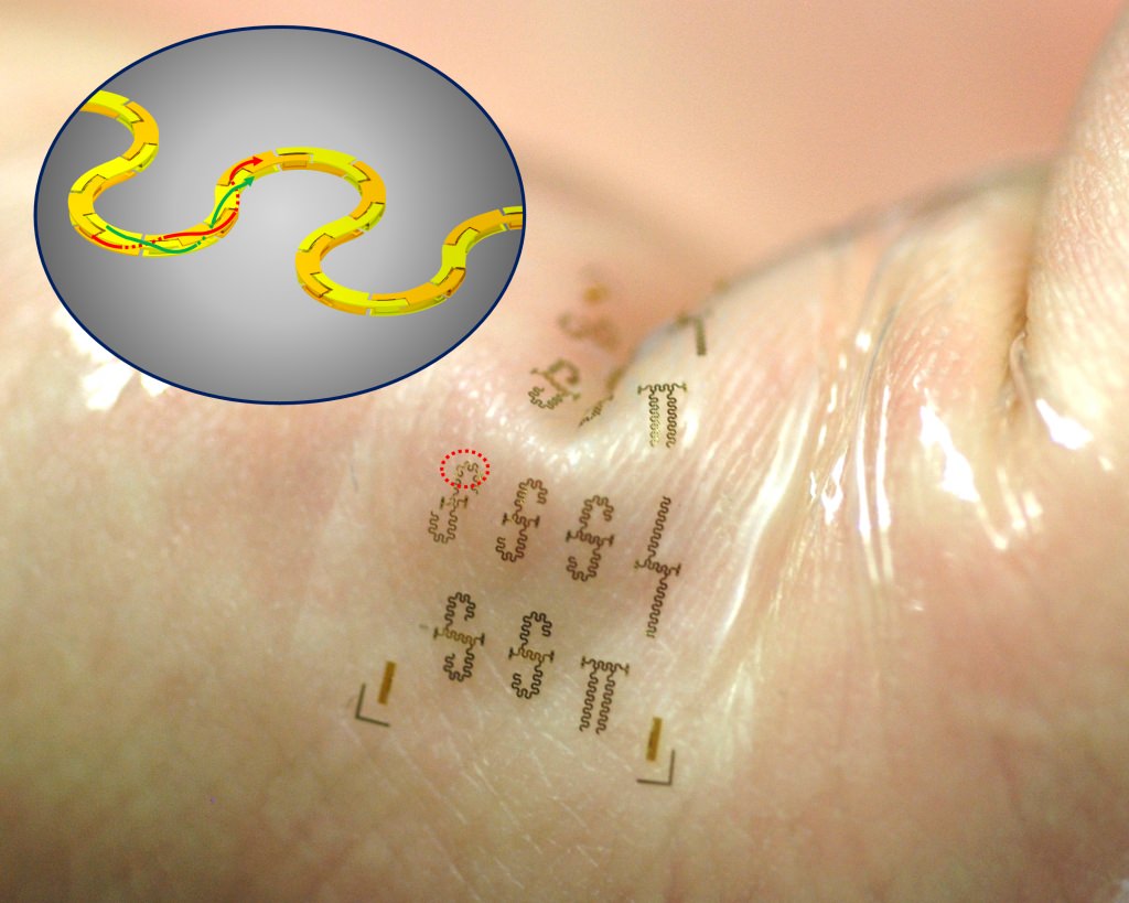 Photo: Stretchable, wearable circuit
