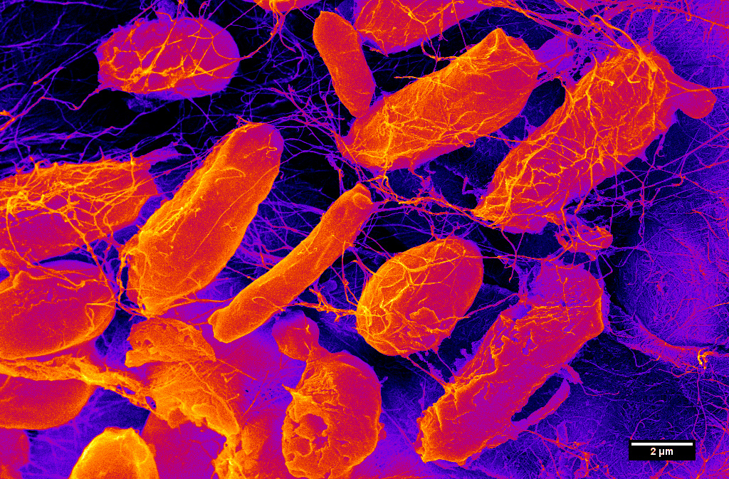 UW-Madison seeks to capitalize on push to harness helpful microbes