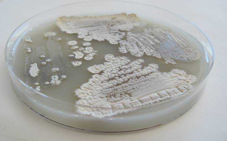 Photo: Streptomyces in petri dish