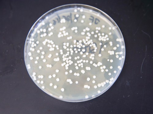 Photo: Culture plate with 'super yeast'