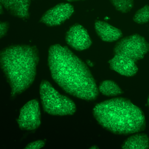 Photo: Micrograph of induced pluripotent stem cells generated from artificial transcription factors. The cells express green fluorescent protein after a key gene known as Oct4 is activated.