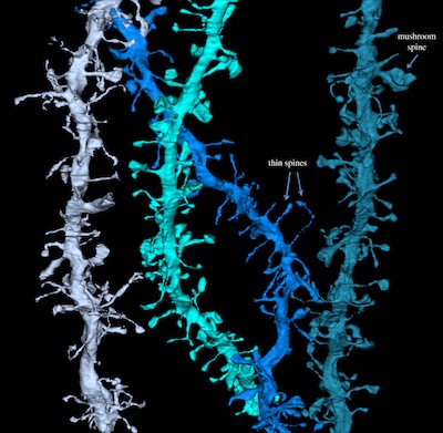 This picture shows 3D reconstructions of electron microscope images of tree branch-like dendrites. At the end of the branches are cup-like structures called the spines, and in the tips of the spines are synapses. By studying thousands of images like these, the Wisconsin researchers showed that the synapses shrink after the mouse sleeps and grow again during the next wakeful period. 
