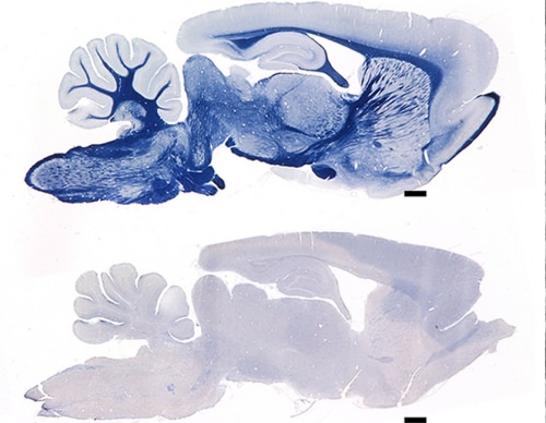 A normal 9-month-old rat has myelin (blue) throughout the brain but the age-matched mutant rat (below) appears to have none. (Scale bar is 1 mm; front of brain is at right.) 