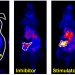 Baseline PET scan shows uptake of manganese chloride tracer in mouse pancreas, in research at the University of Wisconsin-Madison department of radiology. Signal is greatly reduced in mice given a drug that inhibits insulin production, and conversely, intensified in mice given a stimulator of insulin production.

