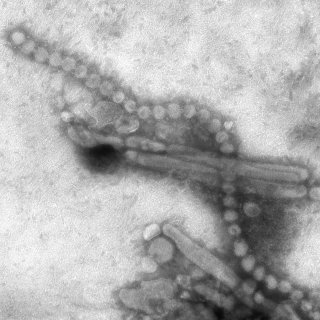 Photo: H7N9 influenza microscopic image