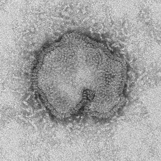 Photo: Influenza A H7N9 as viewed through an electron microscope.
