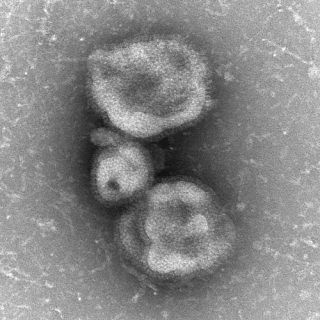 Photo: Influenza A H7N9 as viewed through an electron microscope