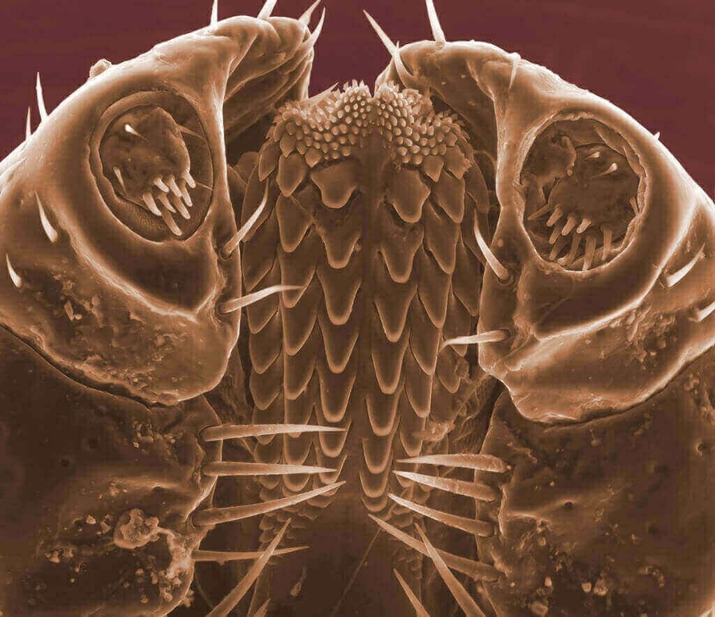 Photo: Microscopic closeup of tick's head