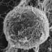 Photo: Micrograph of Ebola virus, which looks like a fibrous sphere or disc