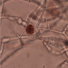 The red pigment and antimicrobial compound bikaverin is shown accumulating in a chlamydospore in the fungus Fusarium fujikuroi. 