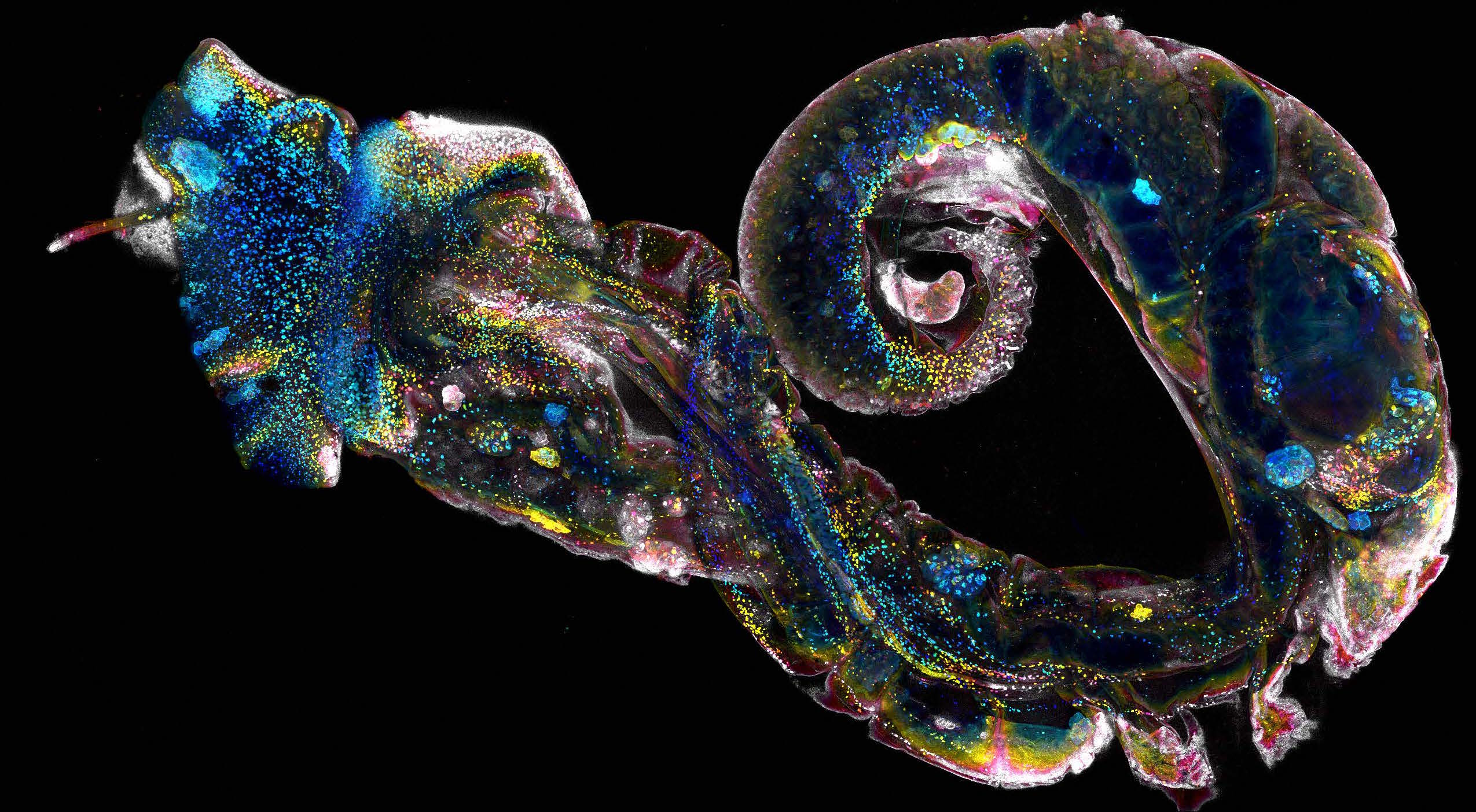 Finding a weak link in the frightful parasite Schistosoma2550 x 1404