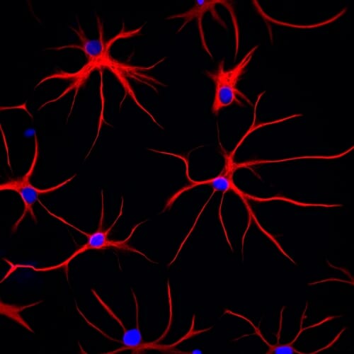 Image: Named for their star shape, these astrocytes — derived from human stem cells — show their structural protein, GFAP, in red. DNA in the cell nucleus appears blue. 
