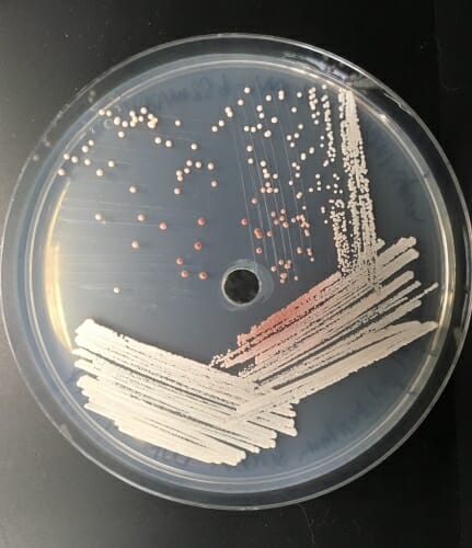 Photo: Red yeast in a Petri dish