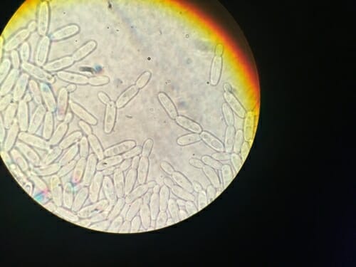 Photo: Pichia exigua, seen through a microscope