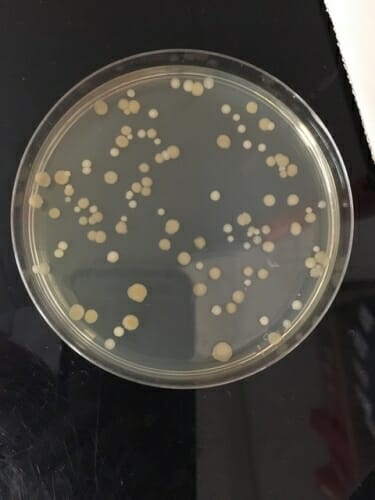 Photo: Petri dish full of bacteria specimens.