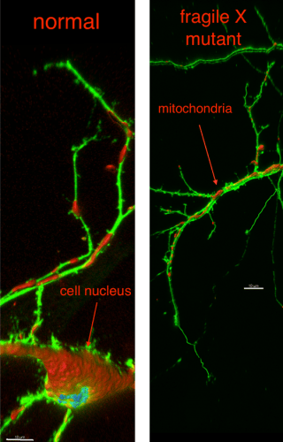 Photo: Microscopic image of a neuron.