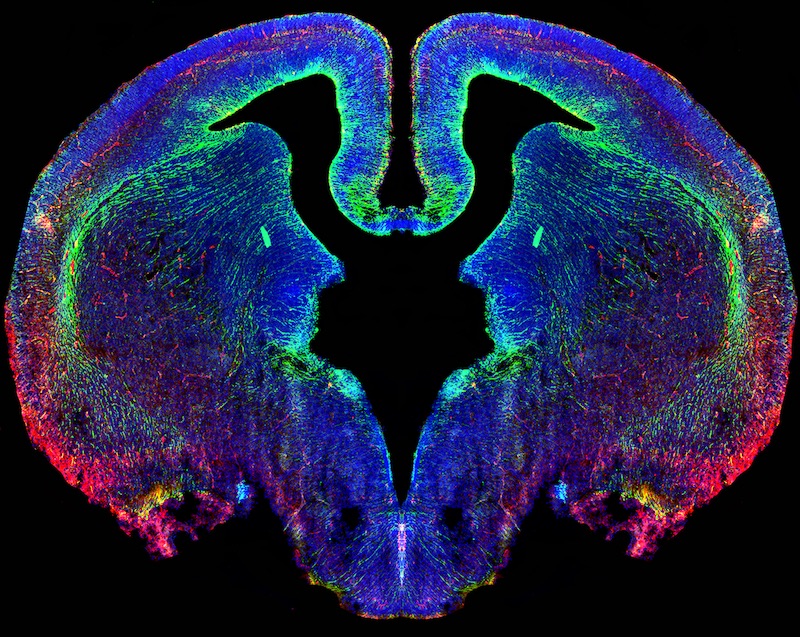 Photo: stem cells in the developing brain of a 16-day-old mouse embryo