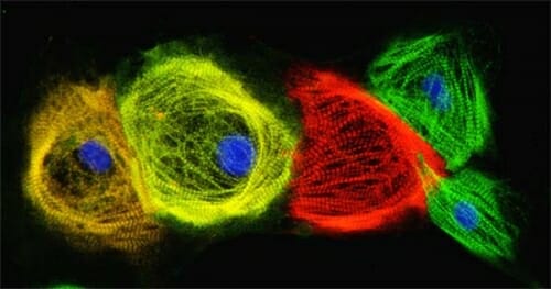 Photo: Colored microscopic image of iPSC-derived crdiomyocytes
