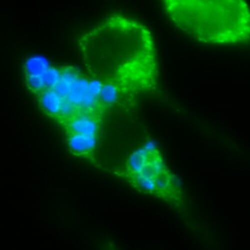 Photo: A blue and green immune cell.