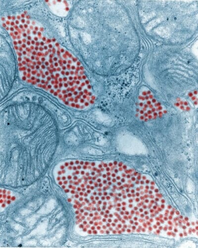 Photo: Microscopic image of virus in mosquito