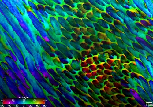 Photo: Colorful microscopic image of tooth enamel crystals