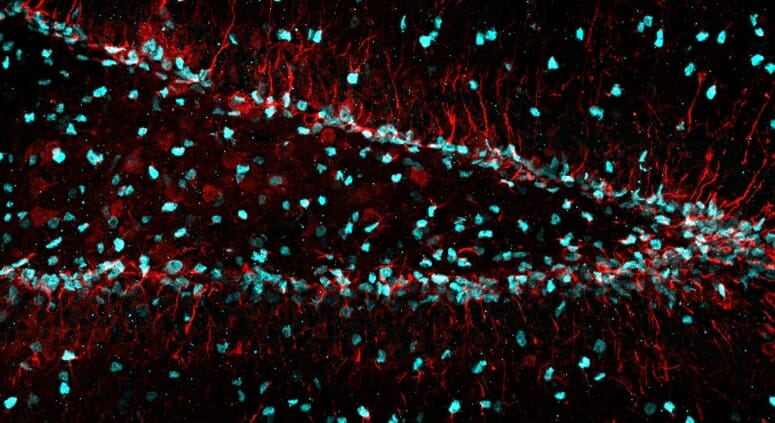 Newswise: Newly identified cellular trash removal program helps create new neurons