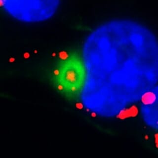 Newswise: Newly identified cellular trash removal program helps create new neurons