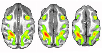 Researchers wake monkeys by stimulating 'engine' of consciousness