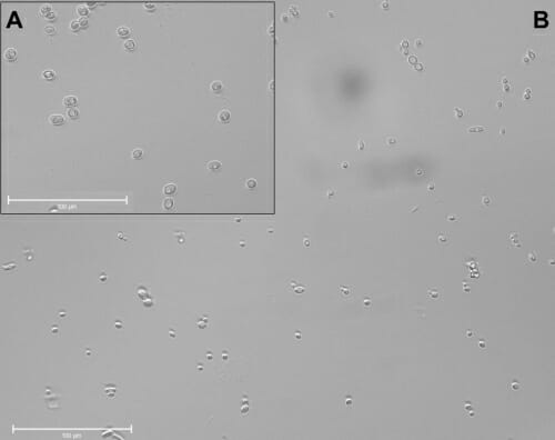 Microscopic image of yeast cells